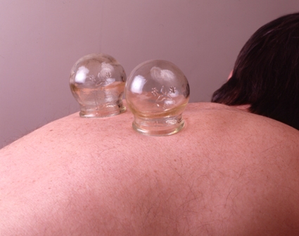 cupping_on_back_300ppi_A6[1]
